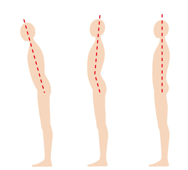 猫背は慢性的な肩こりの原因｜守口市 サンテ鍼灸整骨院