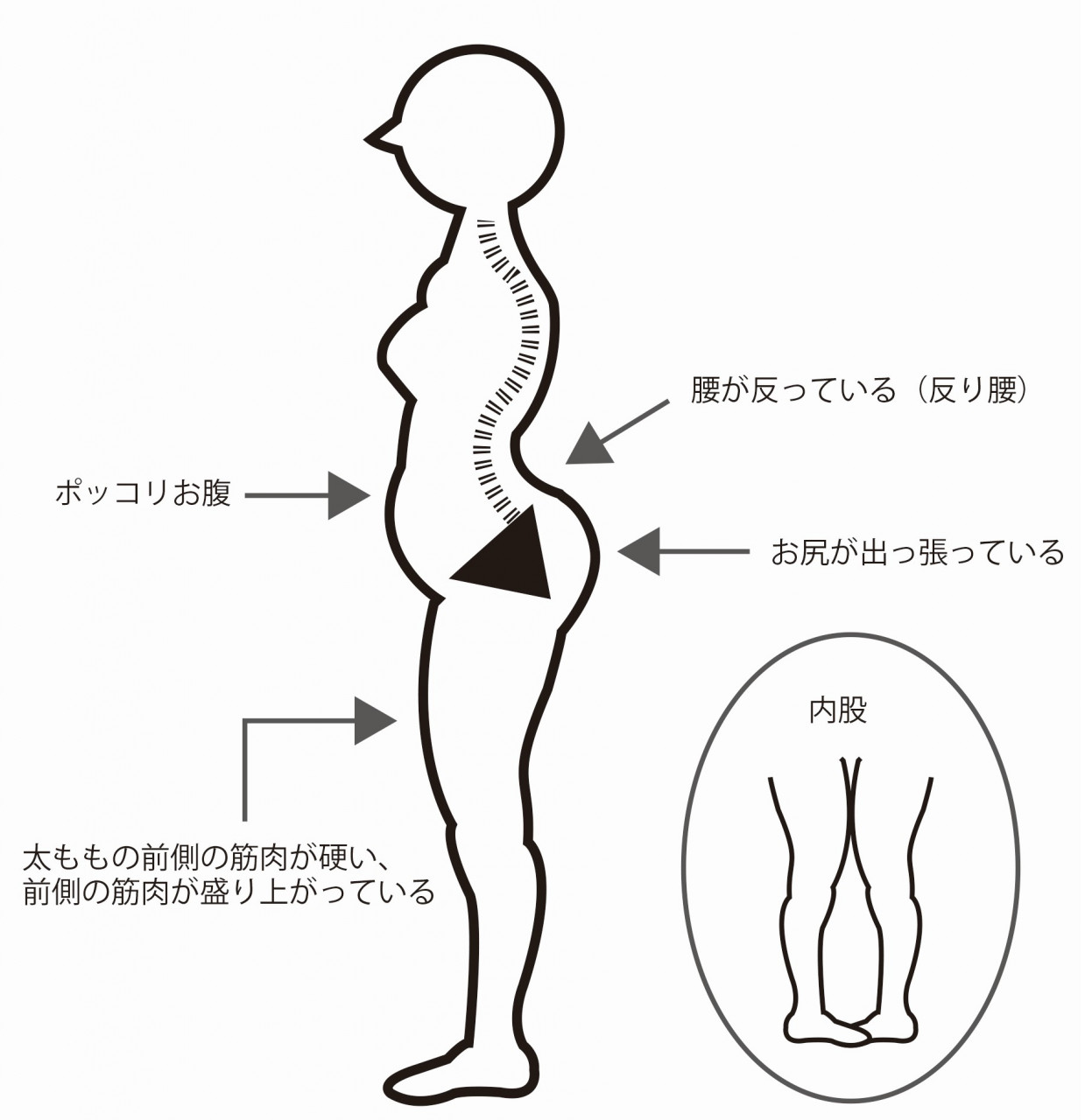 姿勢と骨盤の関係｜守口市｜サンテ鍼灸整骨院